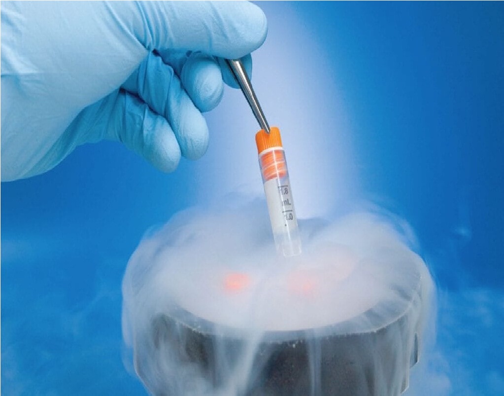 Frozen Embryo Transfer